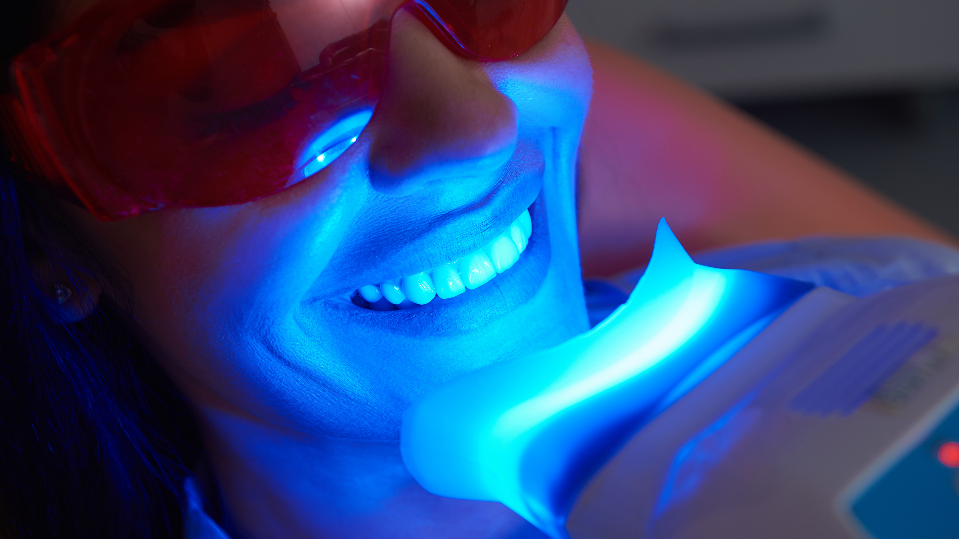 blanqueamiento dental laser con zoom